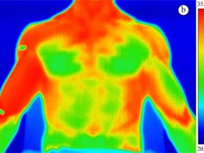 What Are the Applications of Infrared Thermal Imaging Technology in the Medical Field?